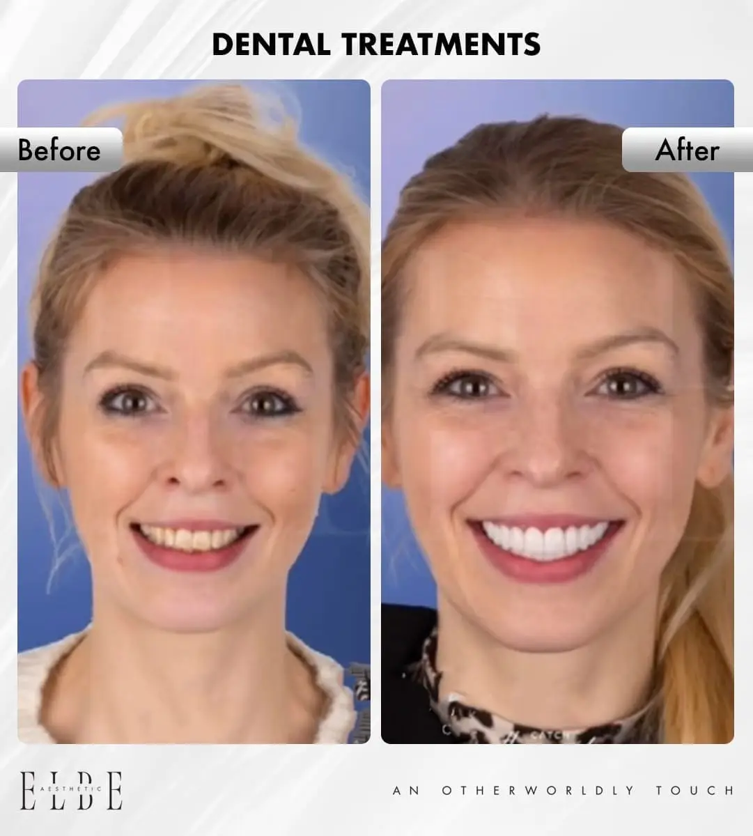 Zabiegi dentystyczne